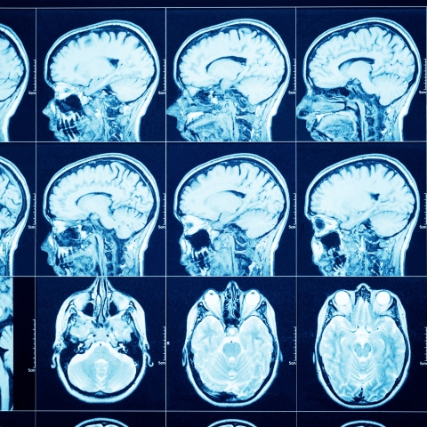 STANDARD LICENSE; PLEASE SEE ADDITIONAL ASSET FOR FULL LICENSE TERMS.