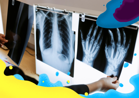 A set of x-rays being examined