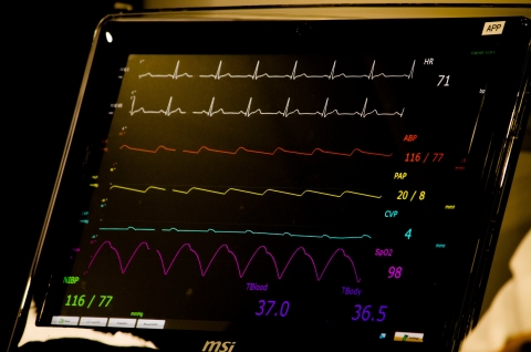 Heart rate monitor with ECG