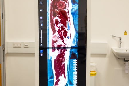 Medical imaging equipment